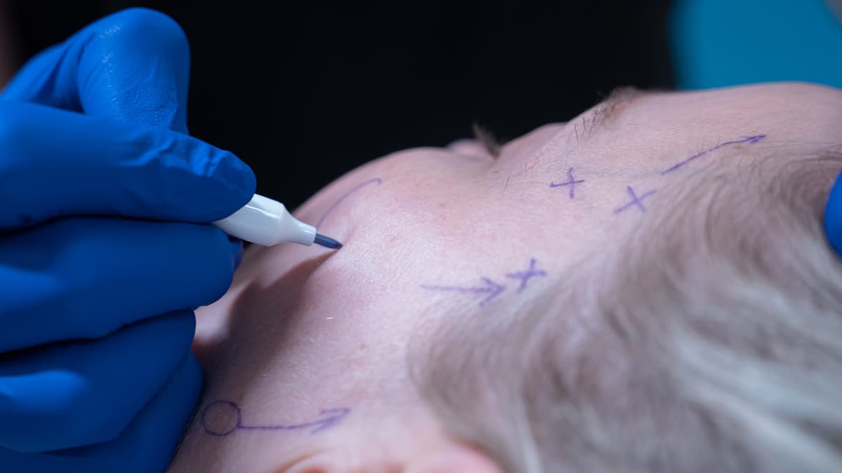 Cosmetic-surgery-101harleystreet