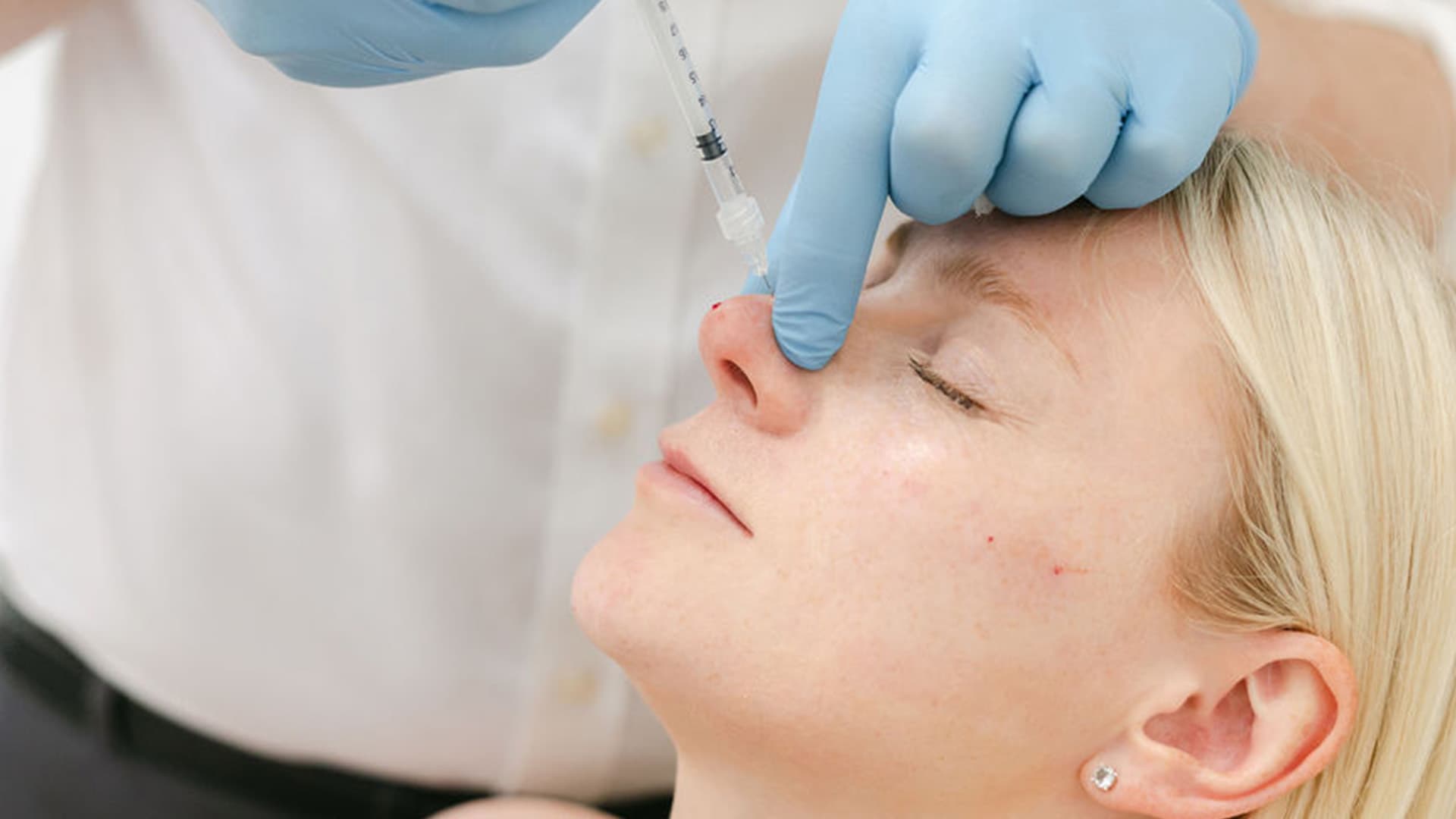 non-surgical-treatment-injection-nose