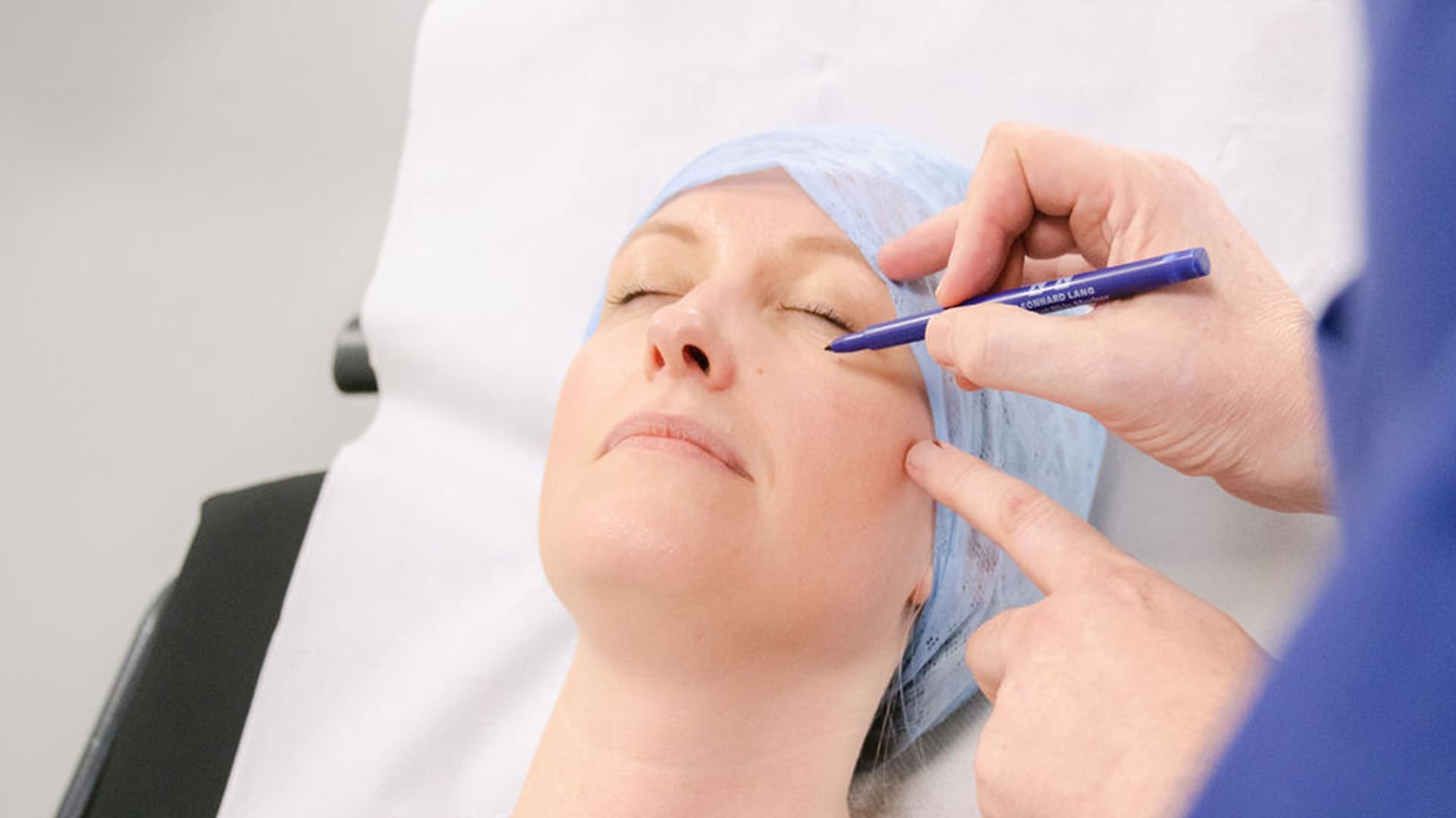 face-surgery-under-eye-marker-pen