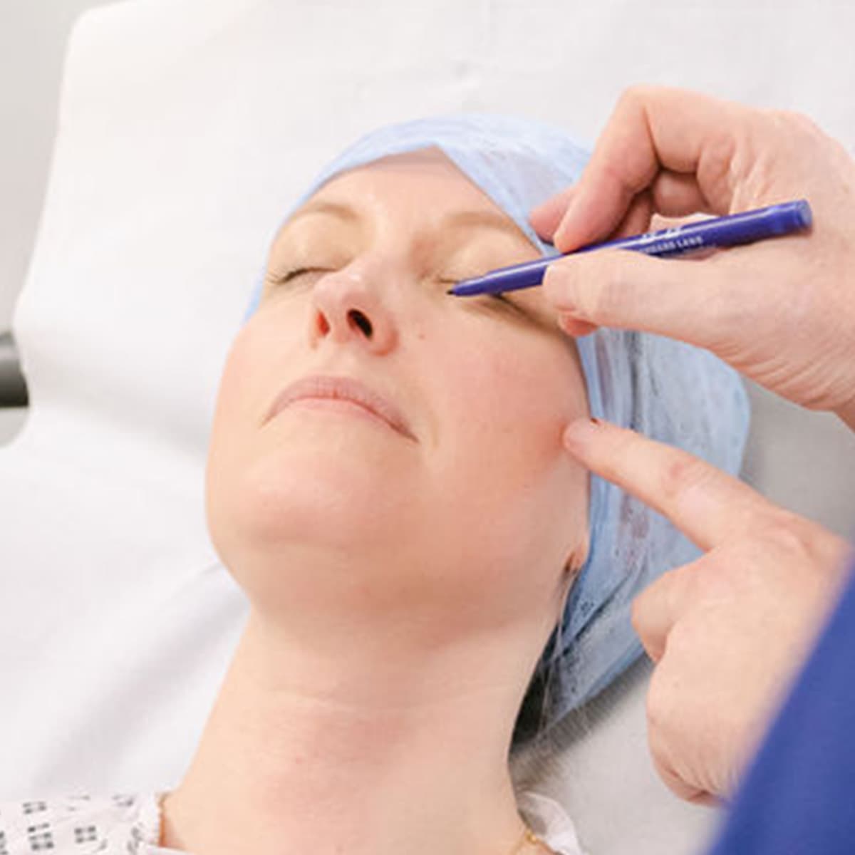 patient-preparation-blepharoplasty