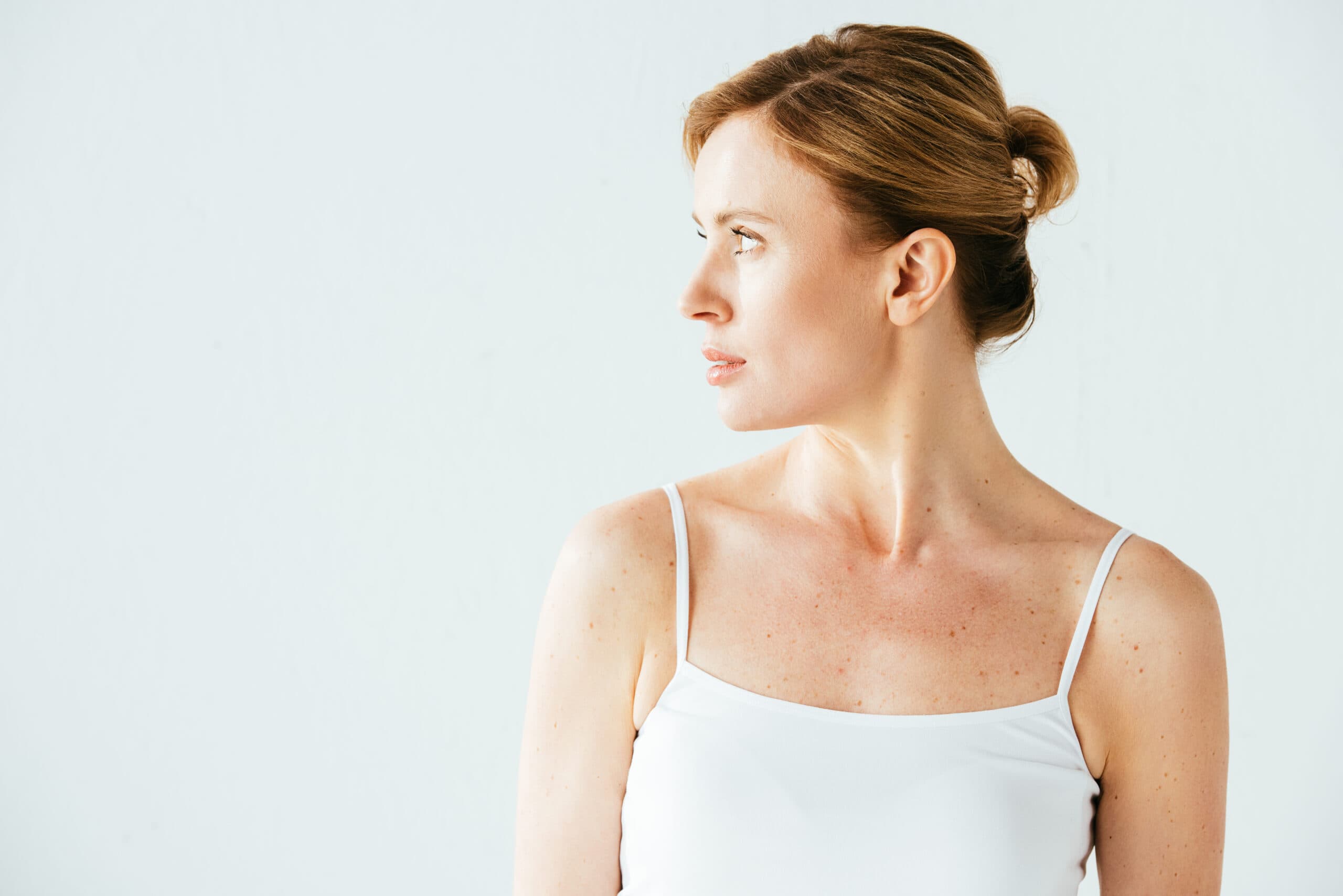 woman-vest-profile-melanoma