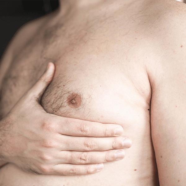 male-chest-checking-for-lumps