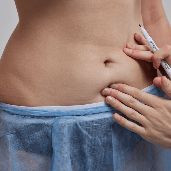 marker-pen-body-before-surgery