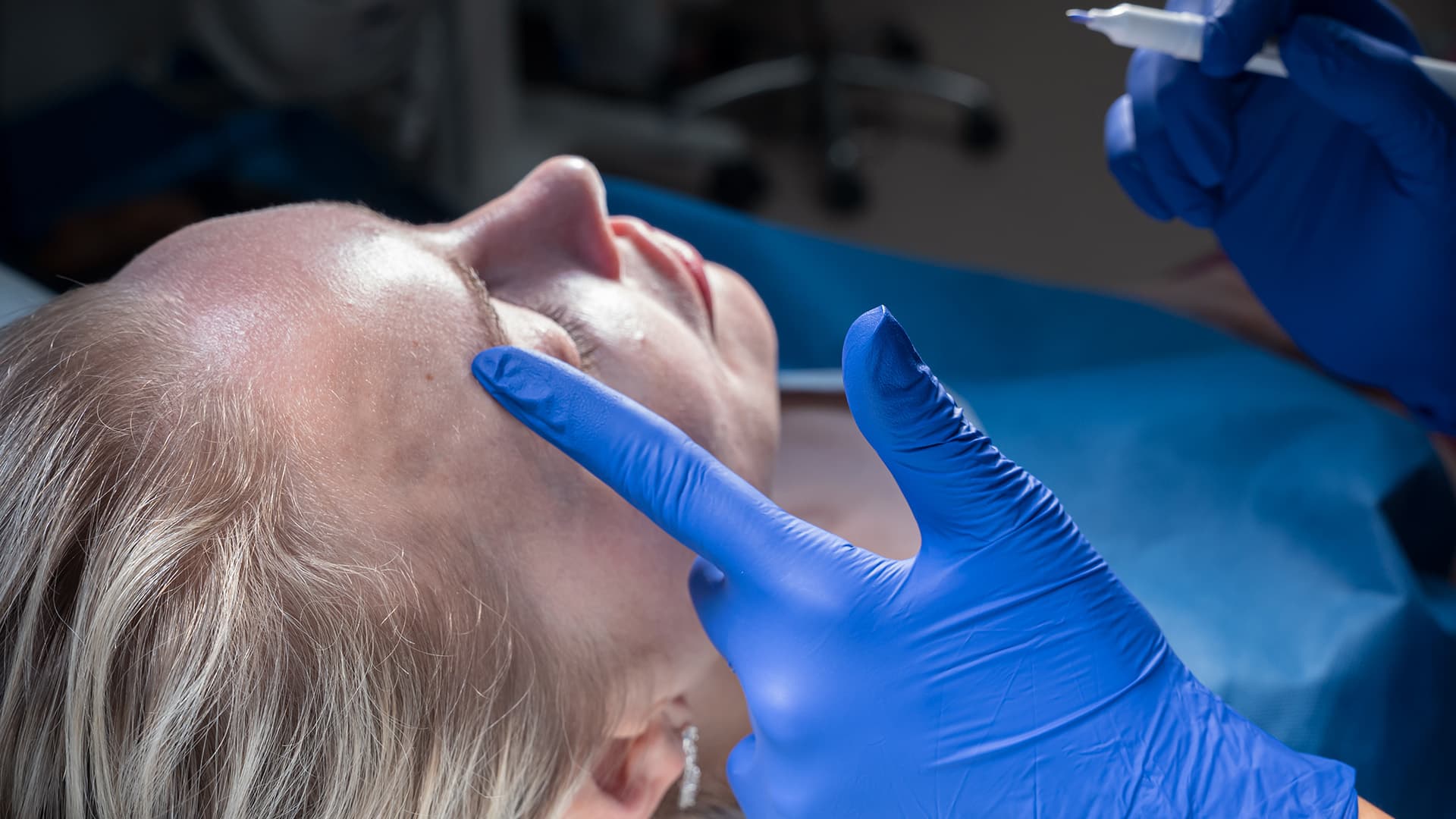 buccal-fat-harley-street